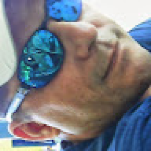 soares